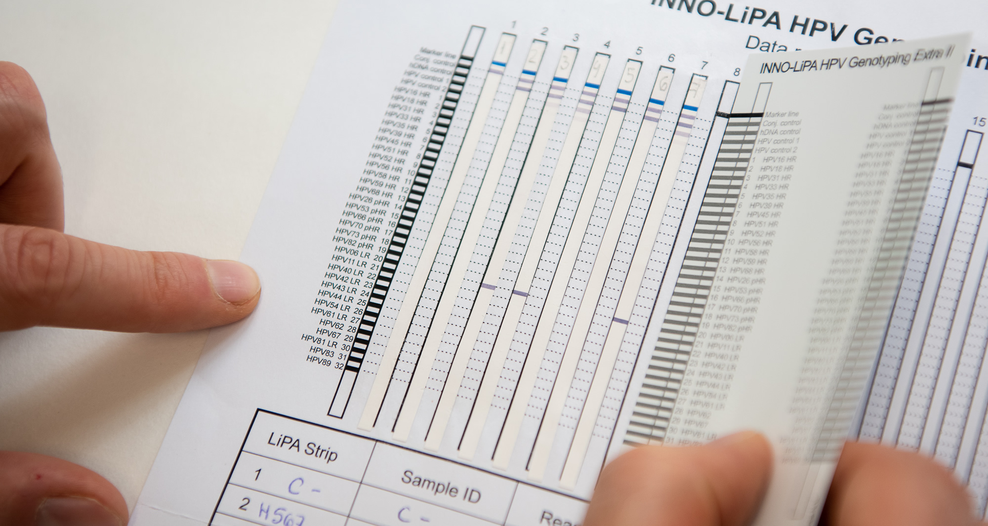 Diagnòstic molecular del càncer